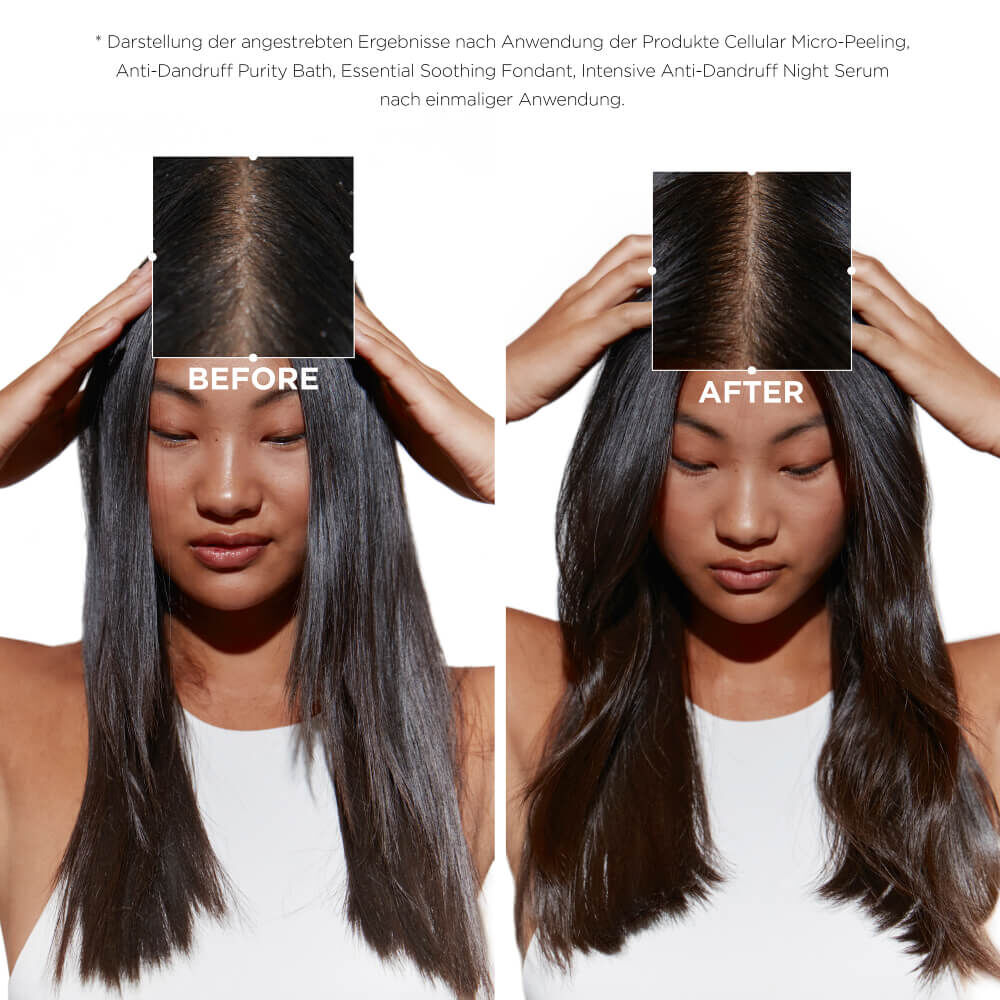 Trio Symbiose Anti-Schuppen-Pflege fur fettige Kopfhaut