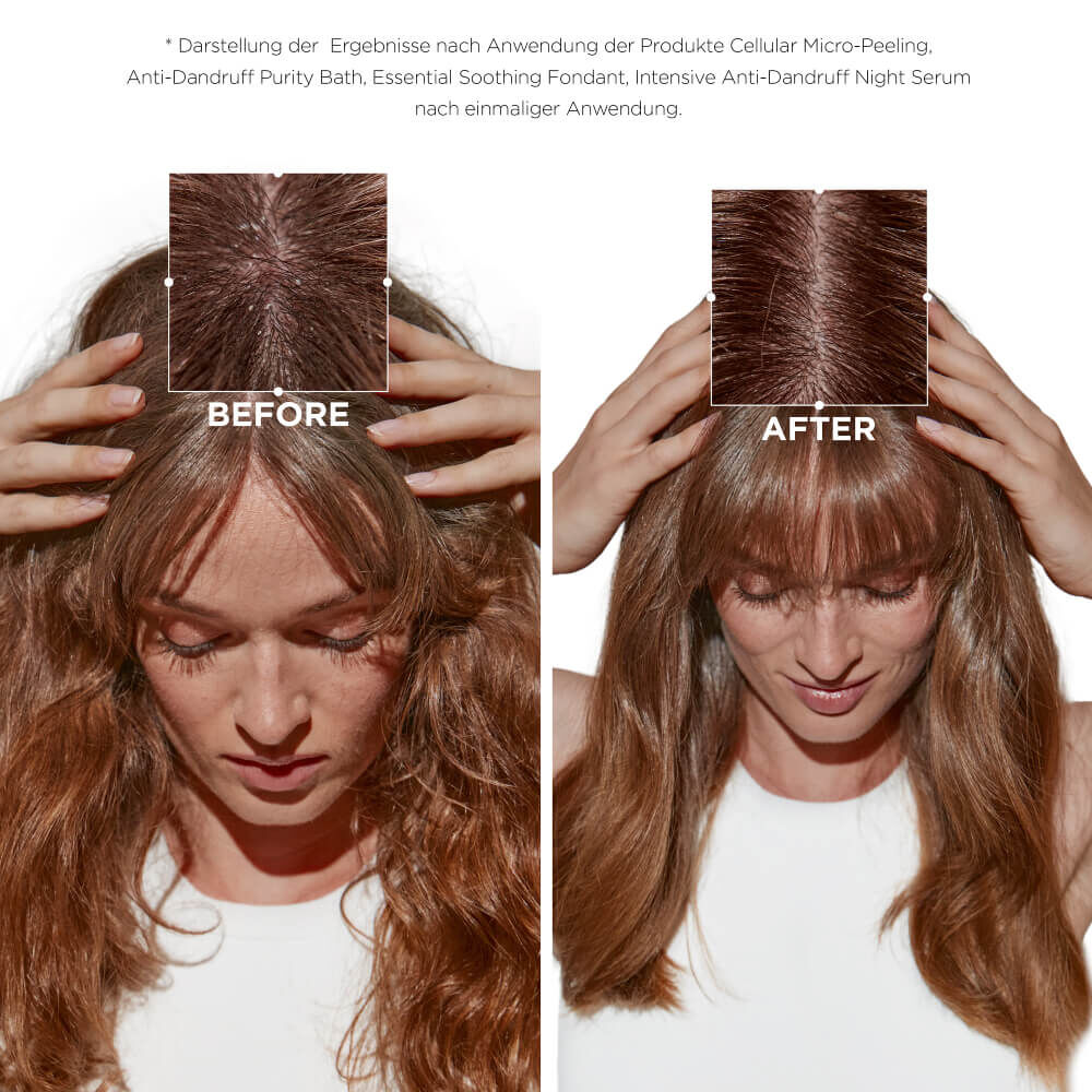 Trio Symbiose Anti-Schuppen-Pflege fur trockene Kopfhaut