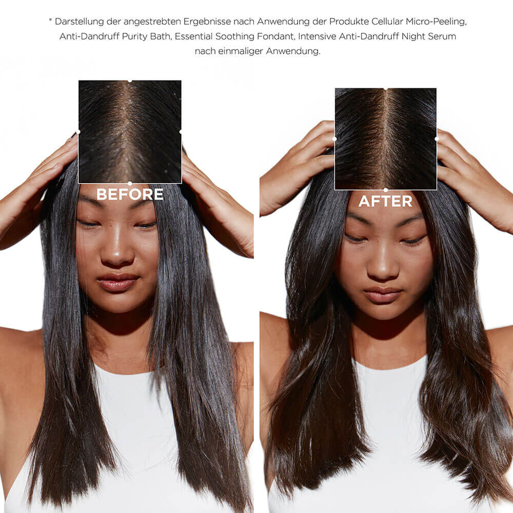 Quartett Symbiose Anti-Schuppen-Pflege fur fettige und empfindliche Kopfhaut